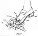 Fig. 15 - Step over walking aid