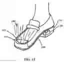 Fig. 17 - Step over walking aid