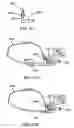 Fig. 23 - Step over walking aid