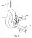 Fig. 33 - Step over walking aid
