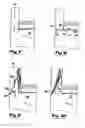Fig. 05 - Freezing furniture and an insert therefor