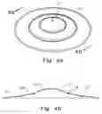 Fig. 05 - Percussion instruments using molten or plasticized metal