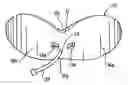 Fig. 01 - Mouthguard