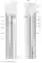 Fig. 01 - Mass Isolation Joint for Electrically Isolating a Downhole Tool