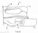 Fig. 03 - Cultivator and tiller