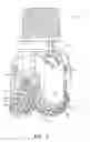 Fig. 02 - ROLLING CONE DRILL BIT HAVING NON-UNIFORM LEGS