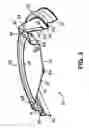 Fig. 04 - LID HAVING A RECLOSABLE SPOUT
