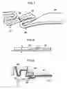 Fig. 07 - Easy open can lid