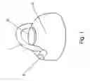 Fig. 02 - Tea kettle with safety features