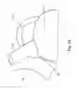 Fig. 44 - Tea kettle with safety features