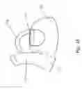 Fig. 46 - Tea kettle with safety features