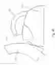 Fig. 48 - Tea kettle with safety features