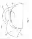 Fig. 52 - Tea kettle with safety features