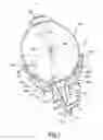 Fig. 02 - Mold and method of injection molding objects made of polymeric materials and object obtained therefrom