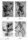 Fig. 02 - Methods for continuous processing polytetrafluoroethylene (PTFE) resin