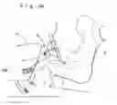 Fig. 35 - Knee protecting airbag device