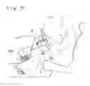 Fig. 66 - Knee protecting airbag device