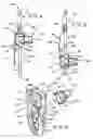 Fig. 03 - Seat belt anchor device and method