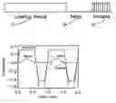Fig. 01 - Arterial spin labeling with pulsed radio frequency sequences