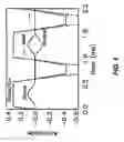 Fig. 07 - Arterial spin labeling with pulsed radio frequency sequences