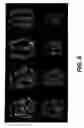 Fig. 09 - Arterial spin labeling with pulsed radio frequency sequences