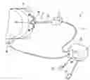 Fig. 01 - Endoscope device