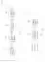 Fig. 02 - Image vibration-compensating apparatus and method thereof