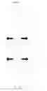 Fig. 08 - METHOD FOR SECURING TWO PARTS OF EYEGLASSES