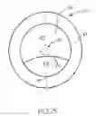Fig. 03 - Bifocal contact lens