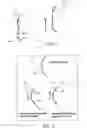 Fig. 04 - Bifocal contact lens