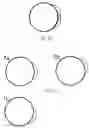 Fig. 05 - Bifocal contact lens