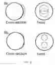 Fig. 06 - Bifocal contact lens