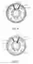 Fig. 05 - Surveillance camera assembly with external adjusting rings