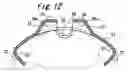 Fig. 13 - Binding tool for documents or the like
