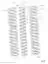 Fig. 05 - Screw pump