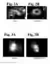 Fig. 03 - Methods of determining βtubulin expression