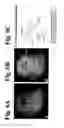 Fig. 05 - Methods of determining βtubulin expression