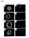Fig. 06 - Method of inducing the differentiation of stem cells into myocardial cells