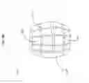 Fig. 05 - Choroid plexus device
