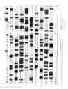 Fig. 04 - Human plasma hyaluronidase