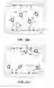 Fig. 04 - Endothelialization of vascular surfaces