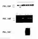 Fig. 08 - Modulation of T Cell Differentiation for the Treatment of T Helper Cell Mediated Diseases