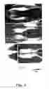 Fig. 17 - Method of treatment using a soluble human delta protein fragment