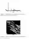 Fig. 02 - Composite biomaterials comprising calcium phospate materials, collagen and glycosaminoglycans