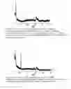 Fig. 09 - Composite biomaterials comprising calcium phospate materials, collagen and glycosaminoglycans