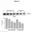 Fig. 07 - Methods for reducing intimal hyperplasia, smooth muscle cell proliferation and restenosis in mammals