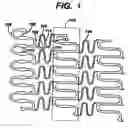 Fig. 02 - Polymeric stent having modified molecular structures in selected regions of the flexible connectors