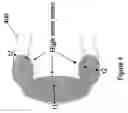 Fig. 05 - Polymeric stent having modified molecular structures