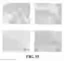 Fig. 16 - PHYTOESTROGENIC COMPOSITION COMPRISING AN EXTRACT OF CHINESE LICORICE ROOT, ISOLIQUIRITIN OR LIQUIRITIN
