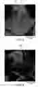 Fig. 03 - Electrolyte membrane, electrode, and fuel cell